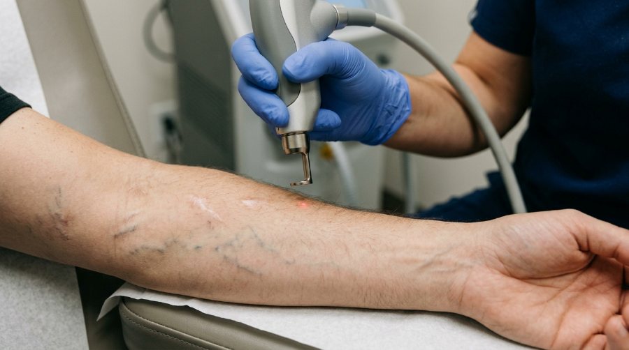 Peau, cicatrices et varices